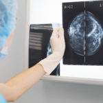 Renowned Breast Surgeon, David Weintritt, MD, Leads Clinical Study for New FDA-Approved Technology in Breast Cancer Surgery that Can Reduce Debilitating Lymphedema to as Low as 5%